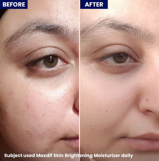 Jenpharm - Maxdif Brightening Moisturizer 100Ml