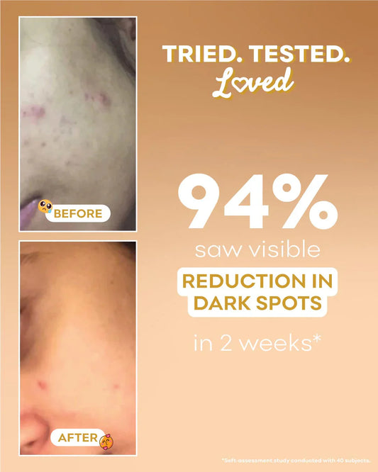 Nirvana Botanics - Rice Brightening Serum