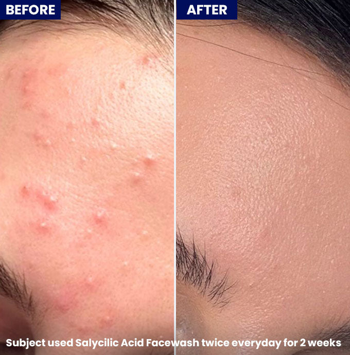 Jenpharm - Salicylic Acid Face Wash