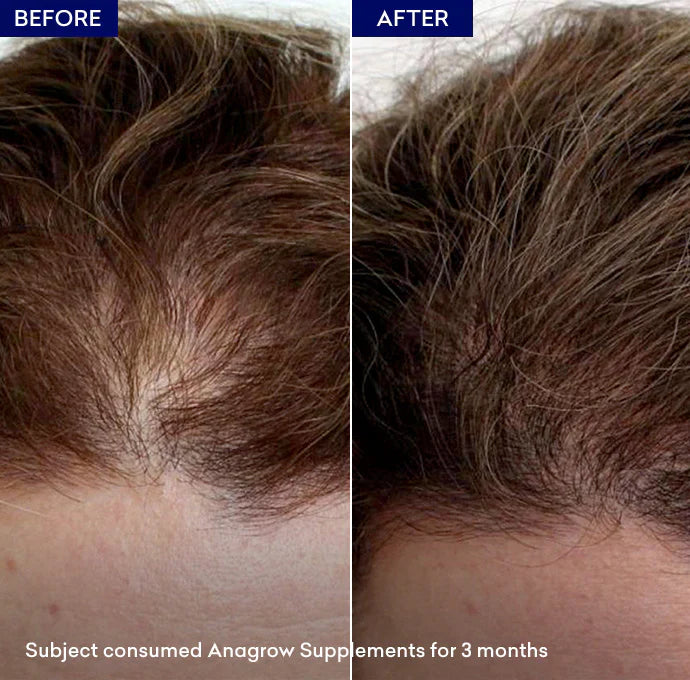 Jenpharm Anagrow Anti Hair-Loss Capsule 30S - Shopify Requirement
