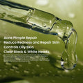 Rivaj Face Serum - Acne Treatment (30ml)