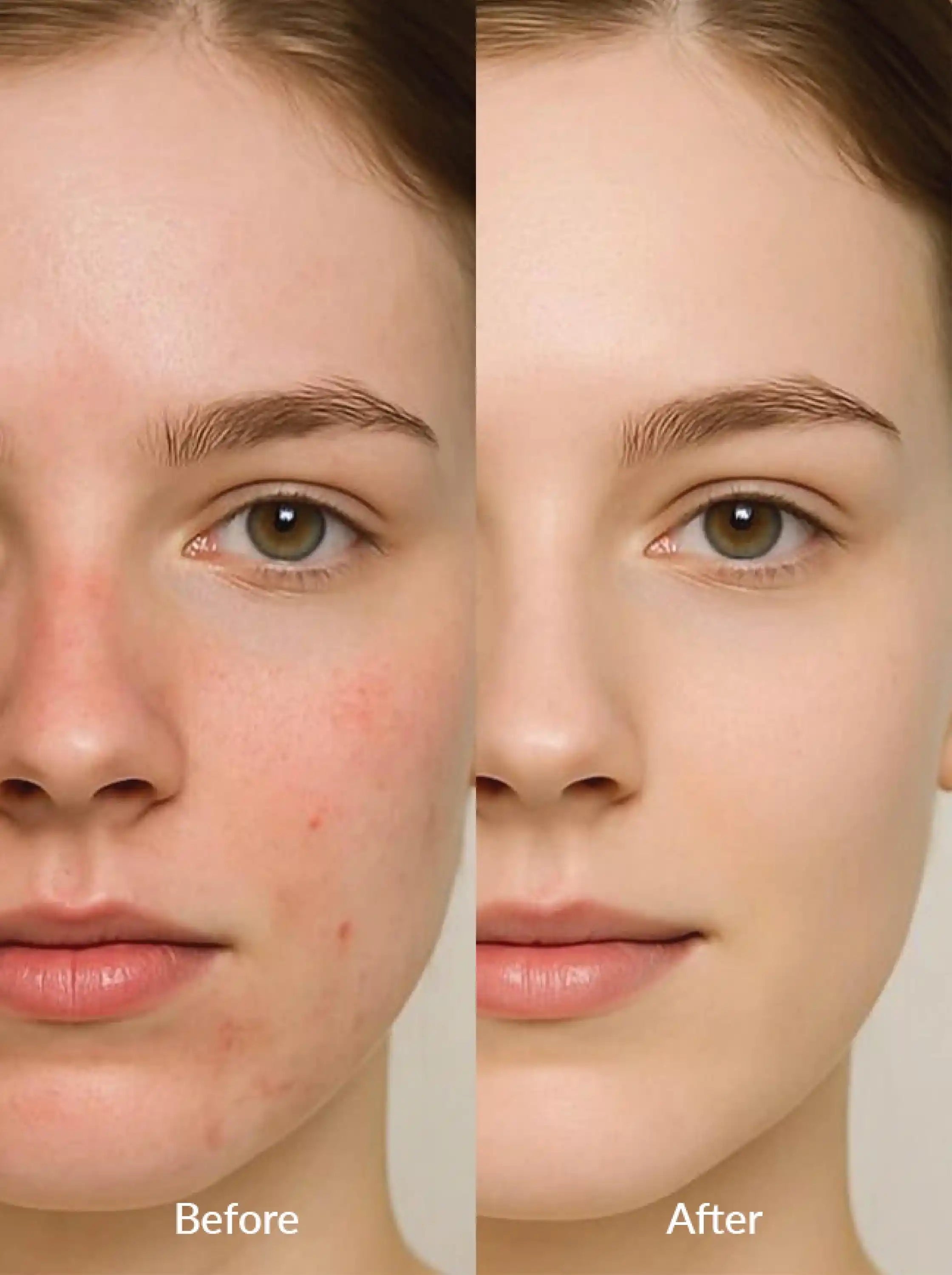 Beautenic - Advanced Barrier Repair Moisturizer