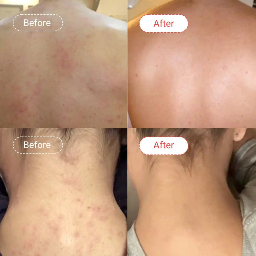 AccuFix - AHA/BHA Body Wash