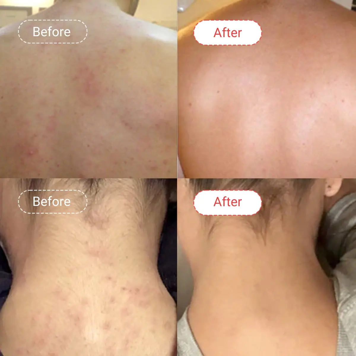 AccuFix - AHA/BHA Body Wash