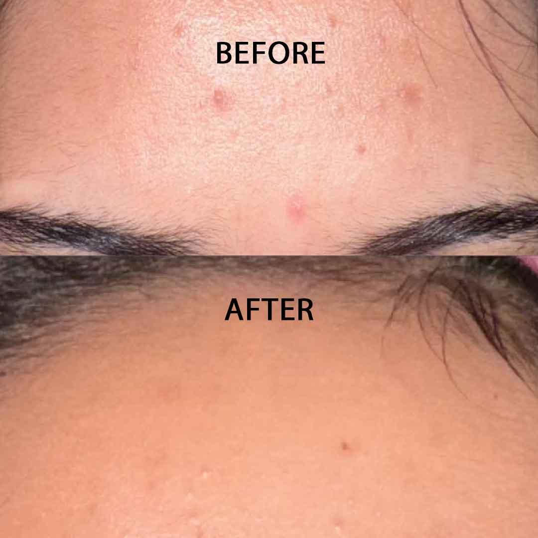 Nirvana Botanics - AHA BHA Exfoliating Treatment