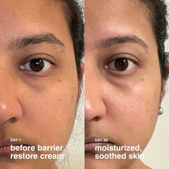 Rhode - Barrier Restore Cream - 30ml
