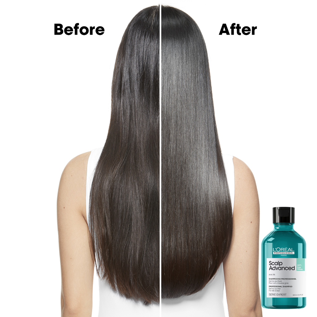 L'Oreal Professional - Serie Expert Scalp Advance Shampoo 300 ML - For Oily Scalp