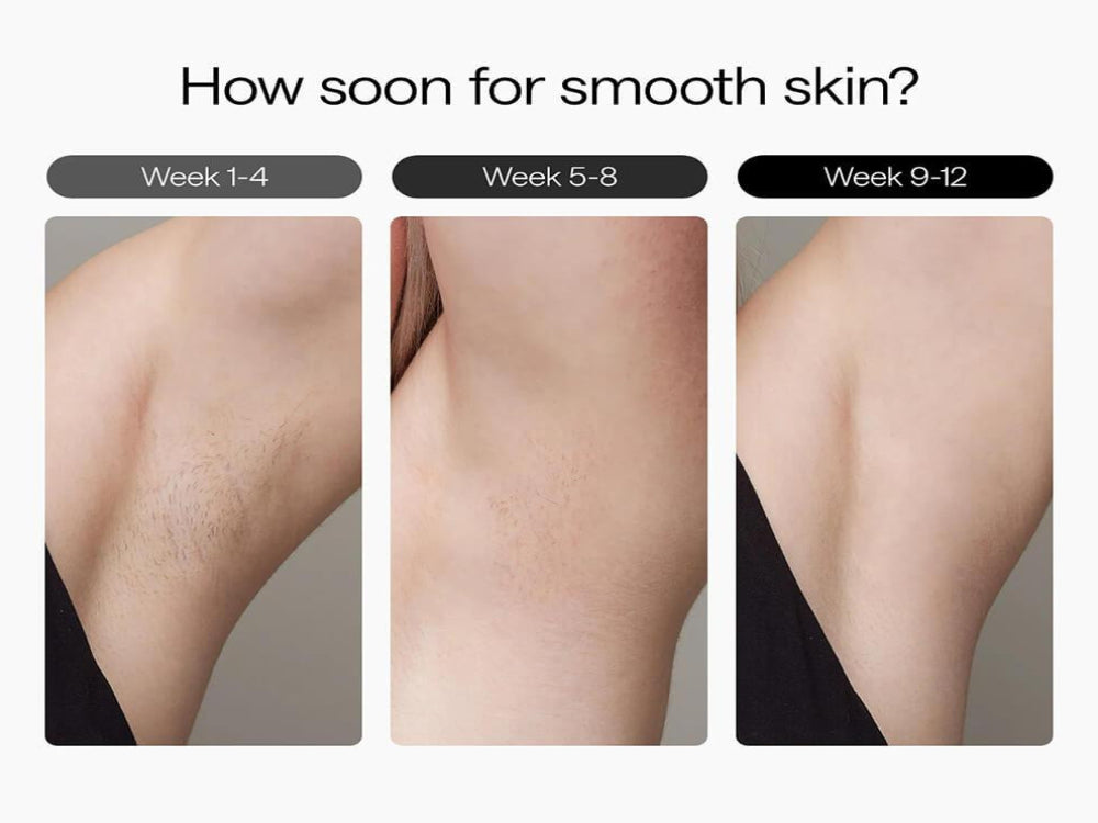 Ulike - Air3 Ice Cooling IPL Hair Removal Device