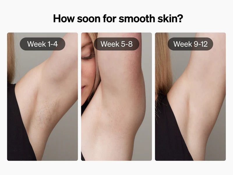 Ulike - Air+ Ice Cooling IPL Hair Removal Device