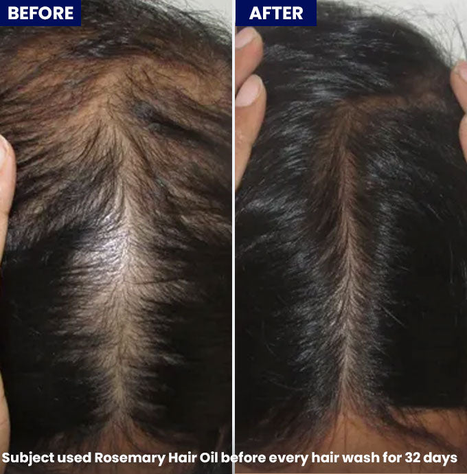 Jenpharm - Anagrow Rosemary Hair Oil