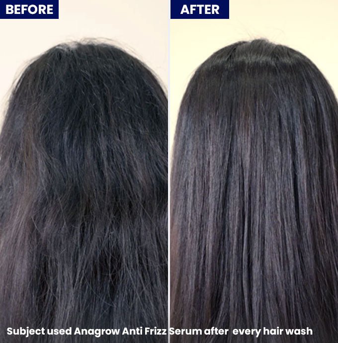 Jenpharm - Anagrow Anti Frizz Hair Serum