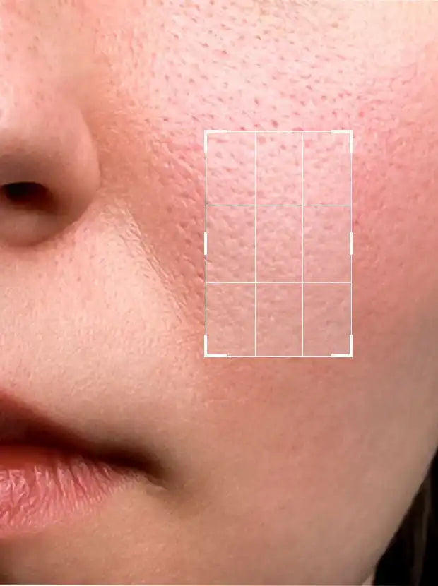 Beautenic - Niacinamide 5% Serum