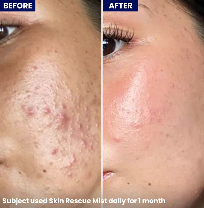 Jenpharm - Skin Rescue Mist